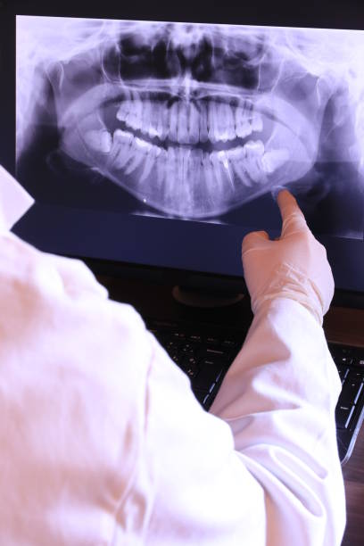 Best Emergency TMJ Treatment in Oak Grove, SC