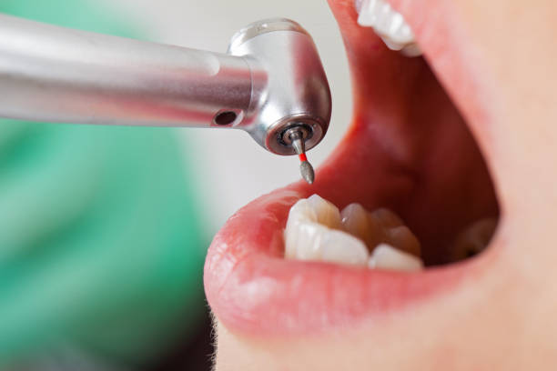 Best Emergency Dental Care for Broken or Chipped Teeth in Oak Grove, SC